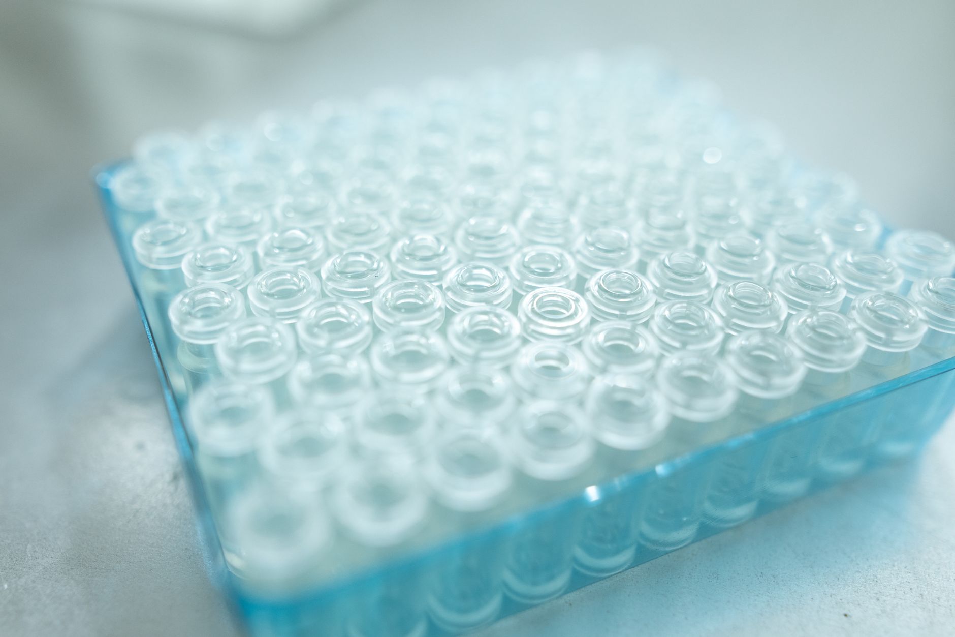Laboratory racks and trays staged for processing and return loops.