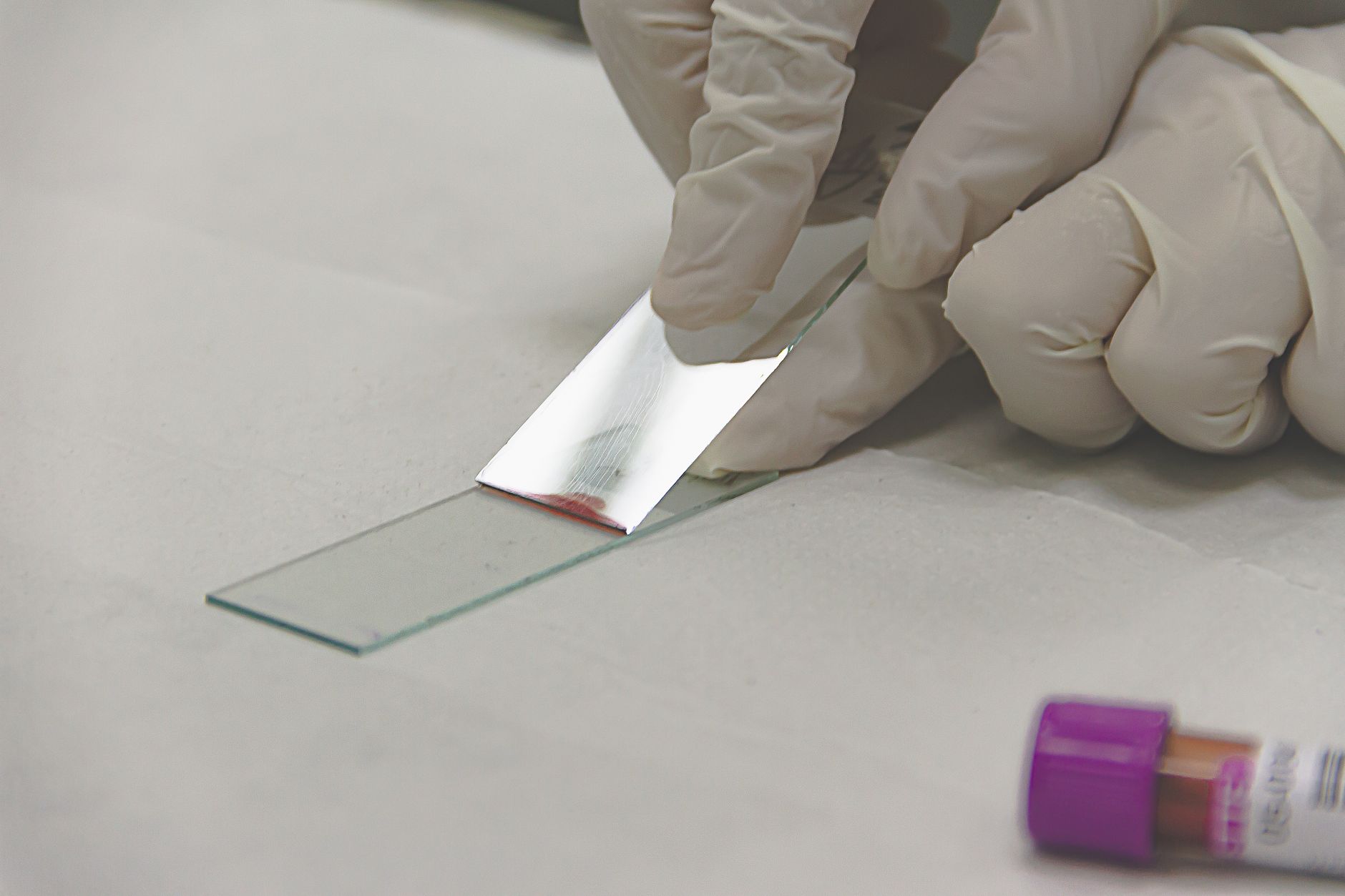 Glass pathology slides arranged securely in individual slots inside a protective slide box.