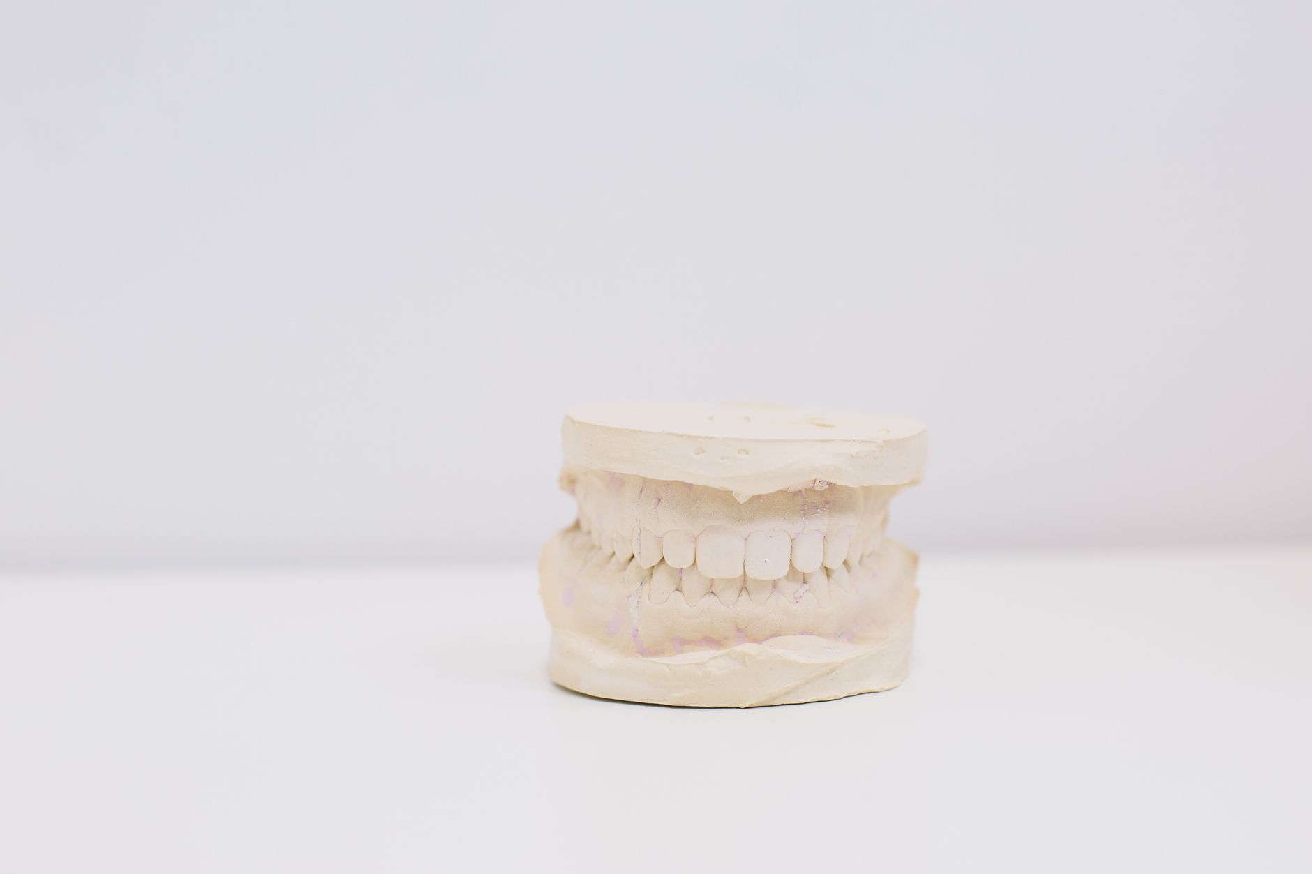 Dental models and casts on a lab counter where technicians prepare arches for polish and grind steps.