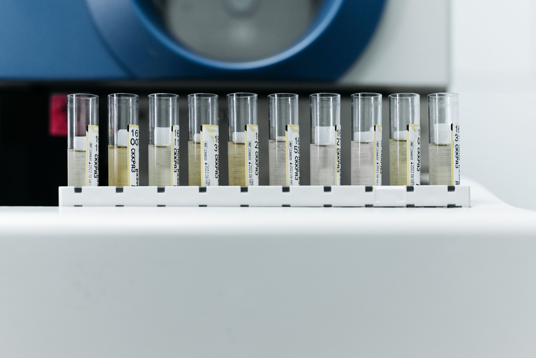 A gloved hand carefully places a rack of patient sample tubes in a medical laboratory, indicating the importance of specimen handling.