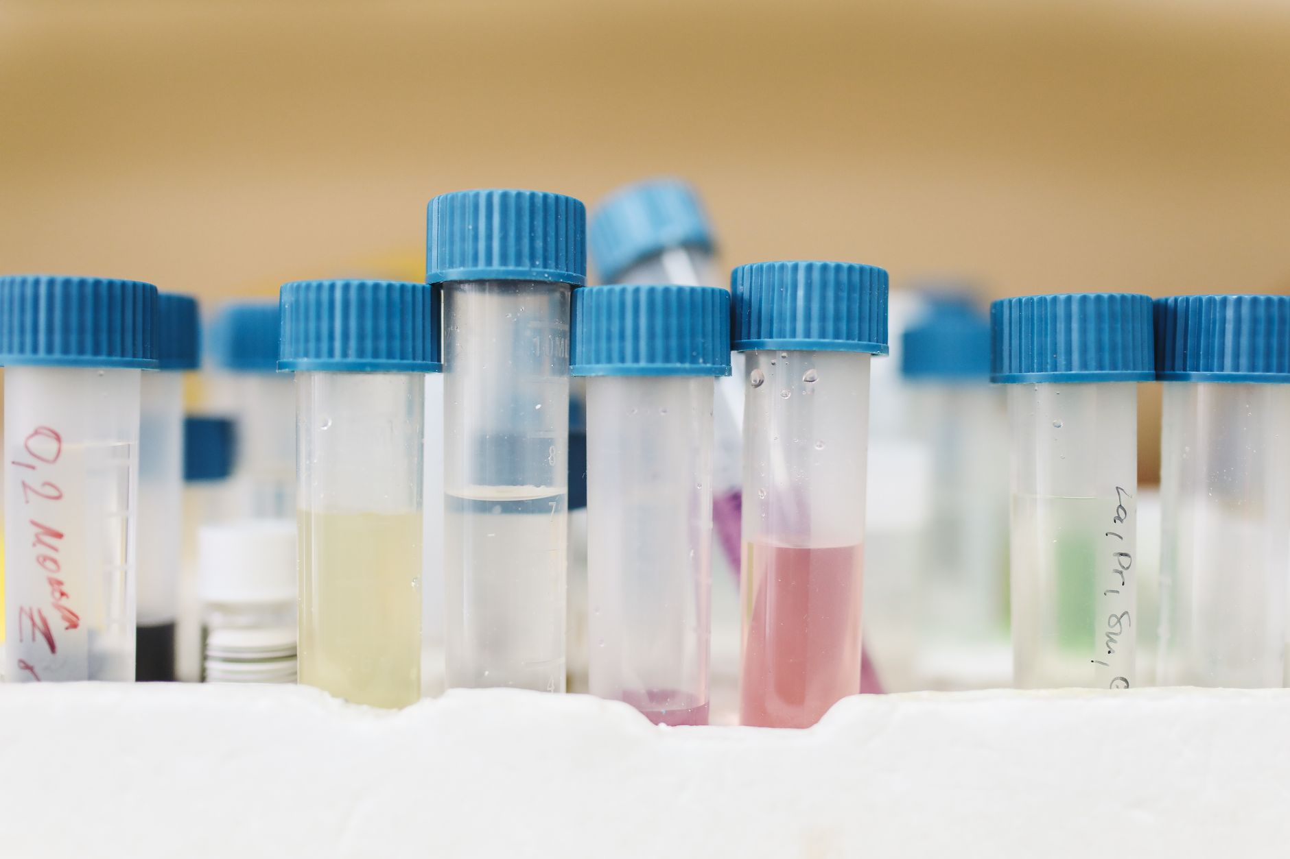 Labeled collection tubes emphasize that throughput depends on the full blood-draw workflow, not only the stick itself.