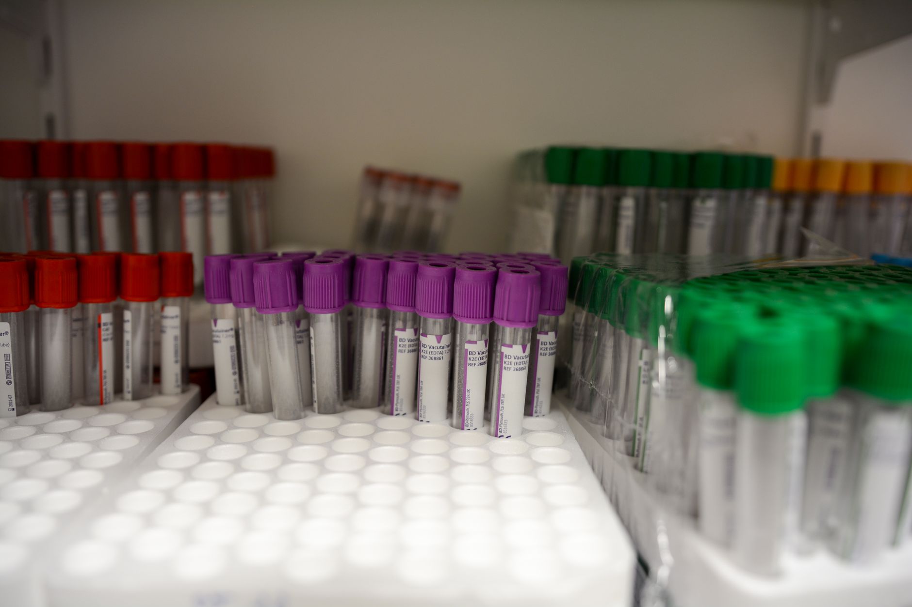 Clinical laboratory bench with labeled specimen containers