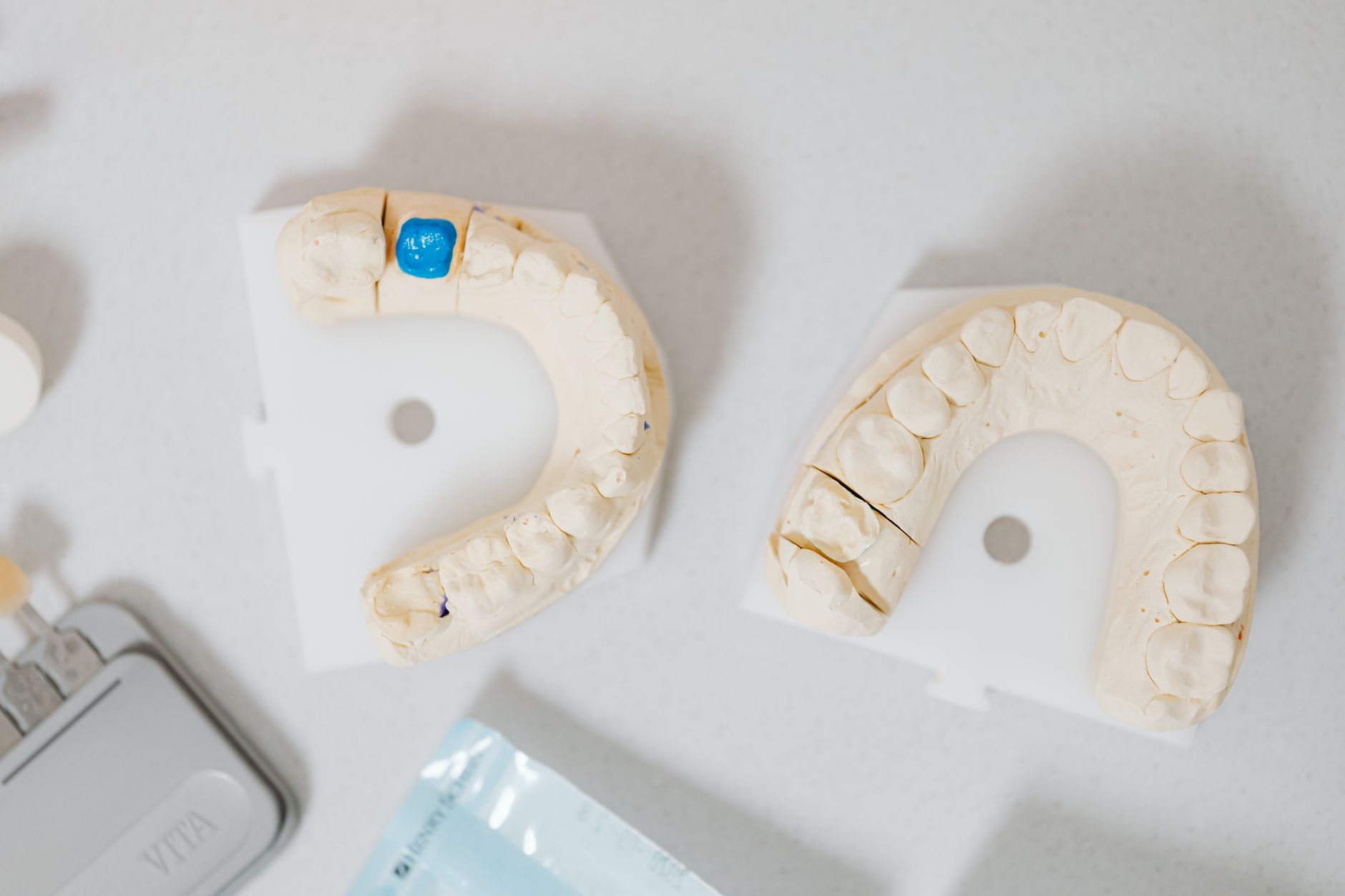 Finished ceramic dental crowns arranged for inspection in a dental laboratory.