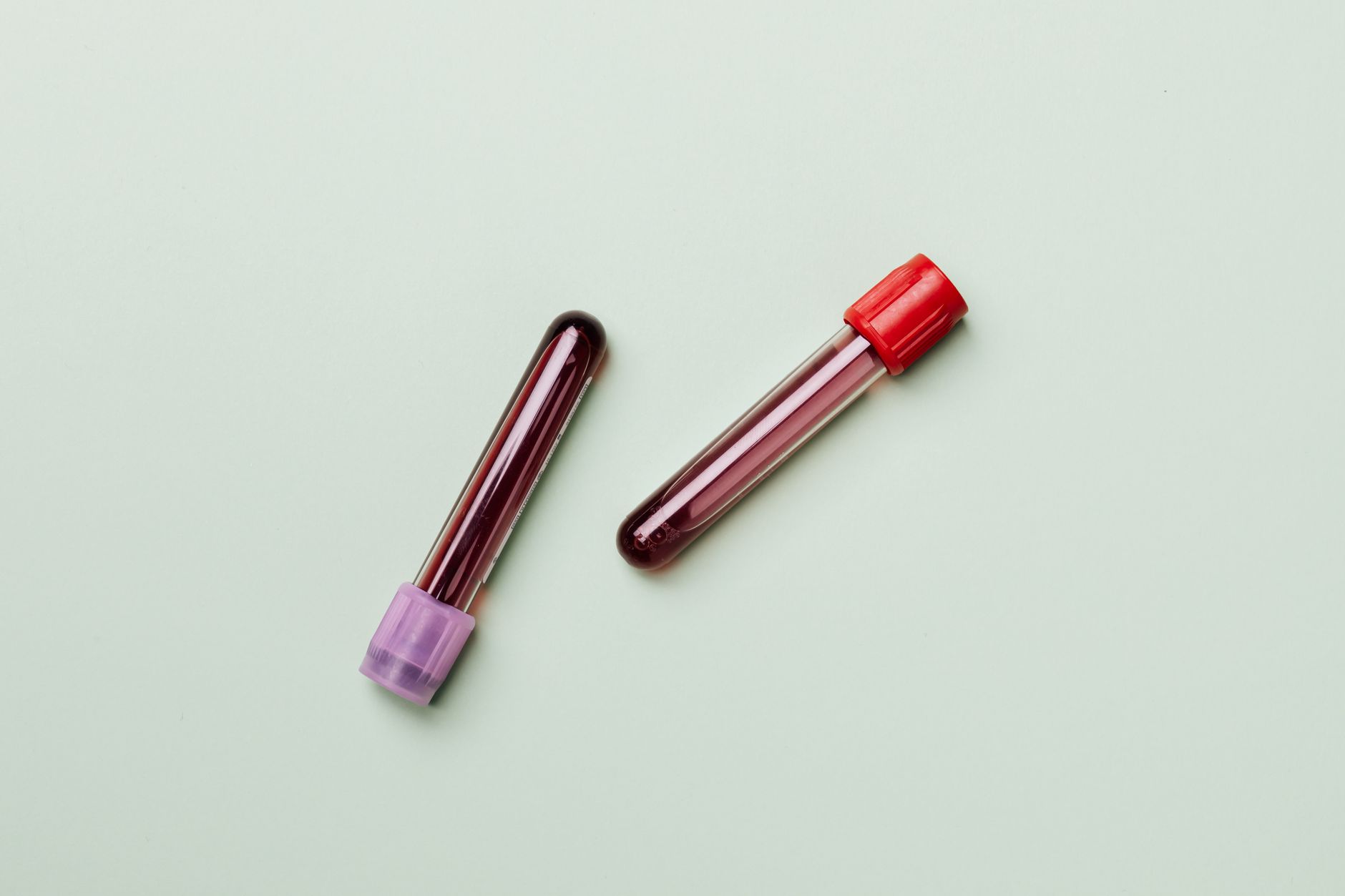 Labeled blood sample tubes await identification and sorting in a hospital laboratory.
